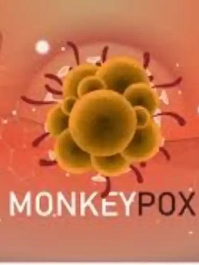 Monkeypox Declared Public Health Emergency in U.S.