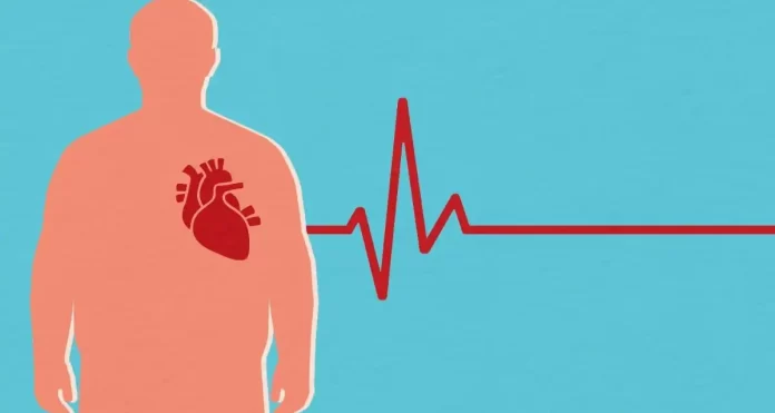 Fatal Heart Attack Vs Heart Attack